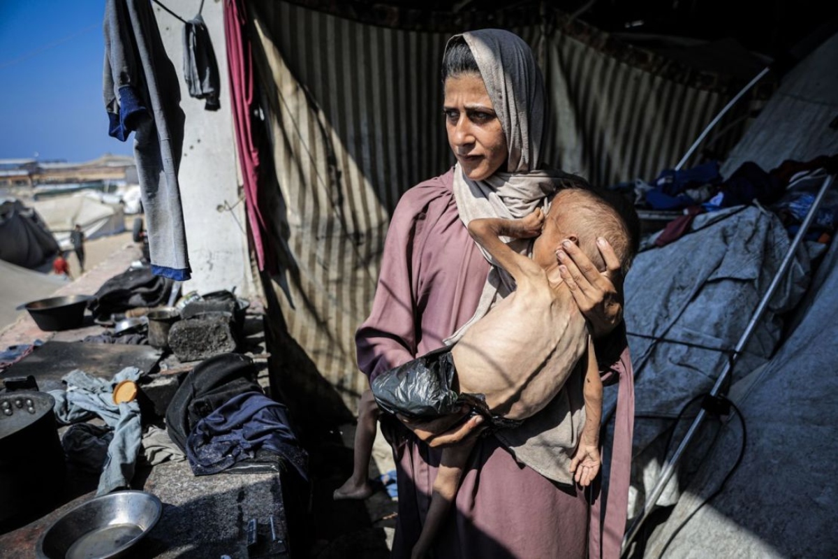 Un 25 % de los niños están desnutridos en Gaza, denuncia MSF 